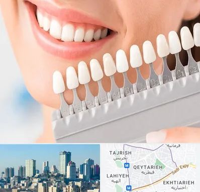 متخصص لمینت دندان در قیطریه 