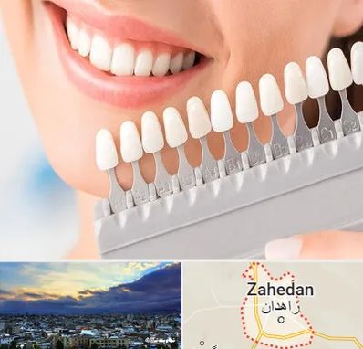 متخصص لمینت دندان در زاهدان