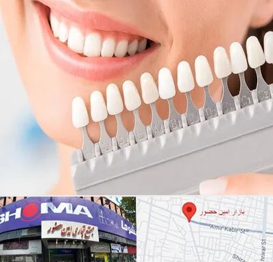 متخصص لمینت دندان در امین حضور