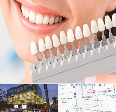 متخصص لمینت دندان در جمهوری 