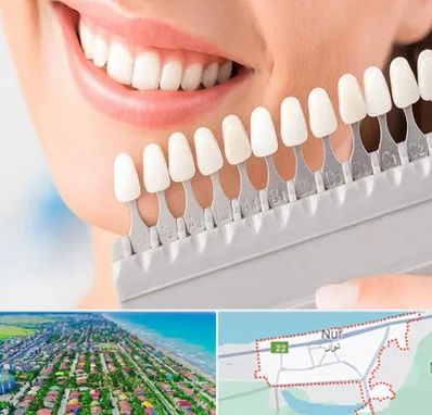 متخصص لمینت دندان در نور