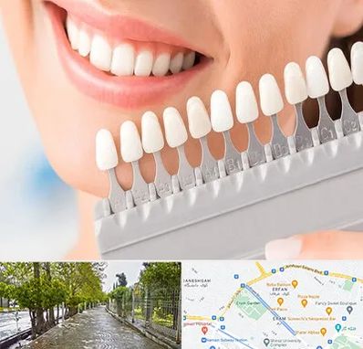 متخصص لمینت دندان در خیابان ارم شیراز