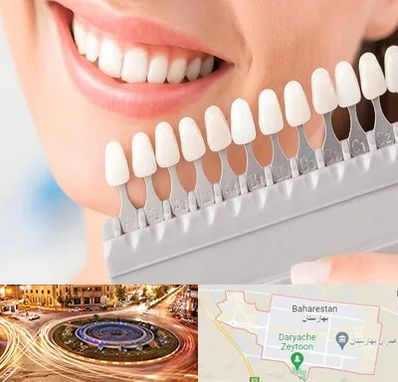 متخصص لمینت دندان در بهارستان