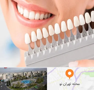 متخصص لمینت دندان در تهران نو