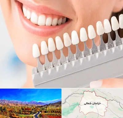 متخصص لمینت دندان در خراسان شمالی