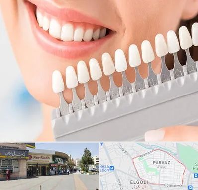 متخصص لمینت دندان در پرواز تبریز