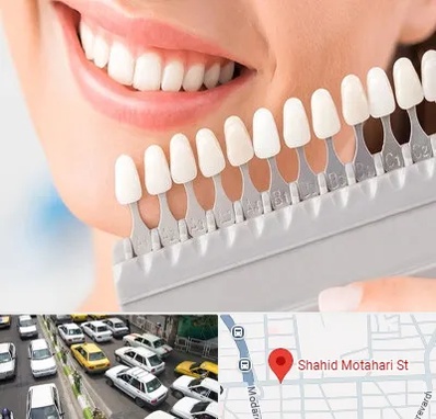 متخصص لمینت دندان در مطهری تهران