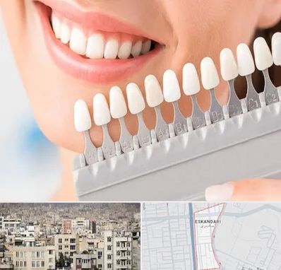 متخصص لمینت دندان در اسکندری
