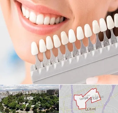 متخصص لمینت دندان در نیروی هوایی
