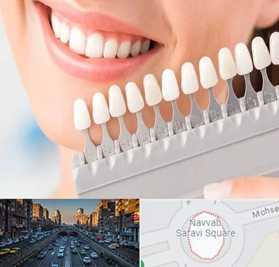 متخصص لمینت دندان در نواب