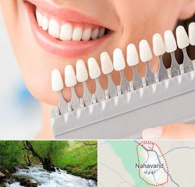 متخصص لمینت دندان در نهاوند