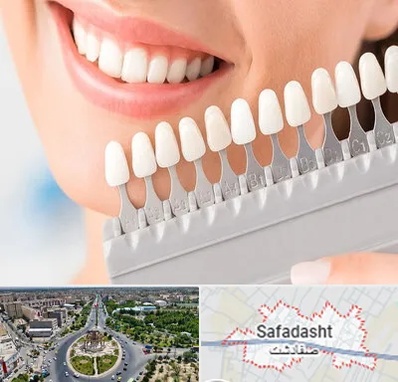 متخصص لمینت دندان در صفادشت