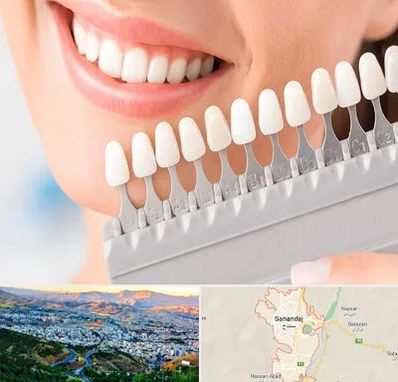 متخصص لمینت دندان در سنندج