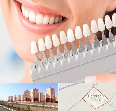 متخصص لمینت دندان در پردیسان قم