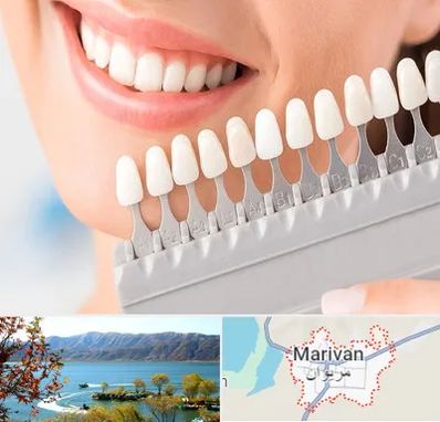 متخصص لمینت دندان در مریوان