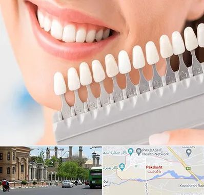 متخصص لمینت دندان در پاکدشت