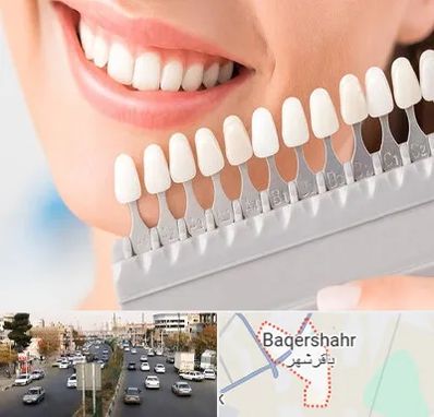 متخصص لمینت دندان در باقرشهر