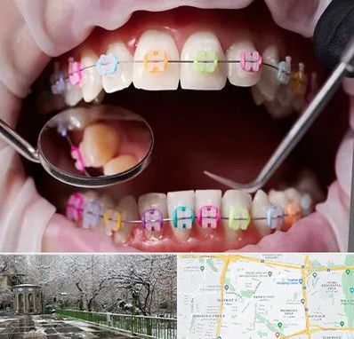 متخصص ارتودنسی در باغ فیض