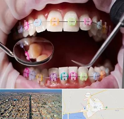 متخصص ارتودنسی در بندر ماهشهر