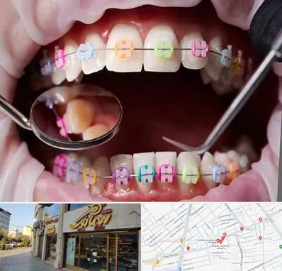 متخصص ارتودنسی در عطاران قم