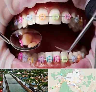 متخصص ارتودنسی در مراغه