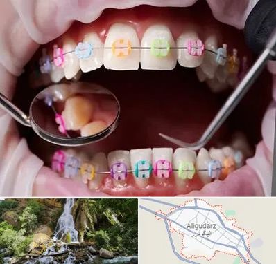 متخصص ارتودنسی در الیگودرز