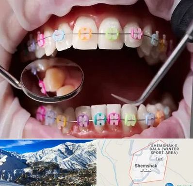 متخصص ارتودنسی در شمشک