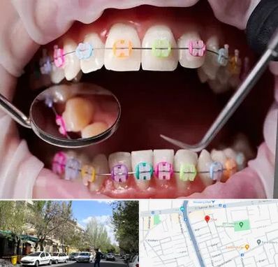متخصص ارتودنسی در کوی فیروز تبریز