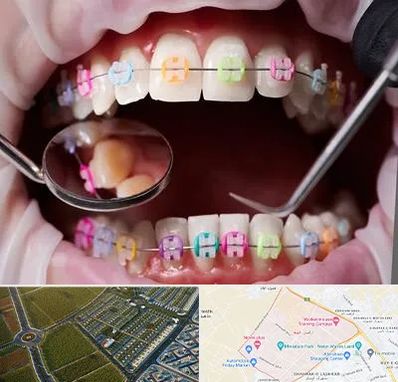 متخصص ارتودنسی در الهیه مشهد