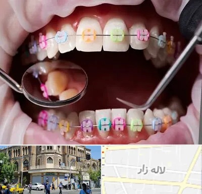 متخصص ارتودنسی در لاله زار