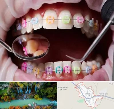 متخصص ارتودنسی در دورود