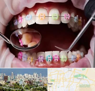 متخصص ارتودنسی در شرق تهران 