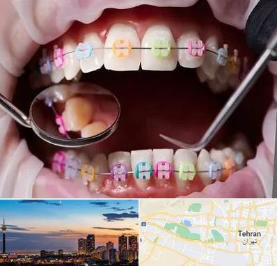 متخصص ارتودنسی در غرب تهران 