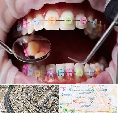 متخصص ارتودنسی در شهرک غرب مشهد