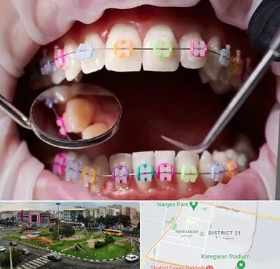 متخصص ارتودنسی در تهرانسر 