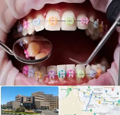 متخصص ارتودنسی در صیاد شیرازی مشهد