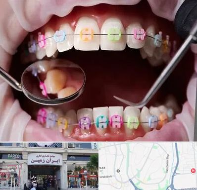 متخصص ارتودنسی در ایران زمین