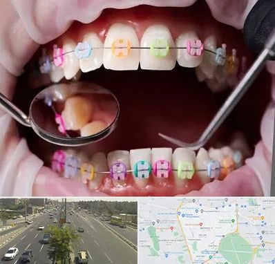 متخصص ارتودنسی در منطقه 17 تهران