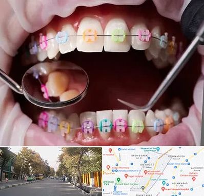 متخصص ارتودنسی در شریعتی 