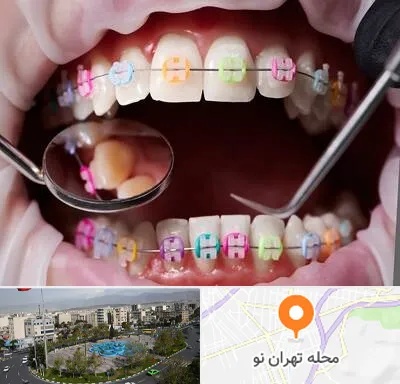 متخصص ارتودنسی در تهران نو