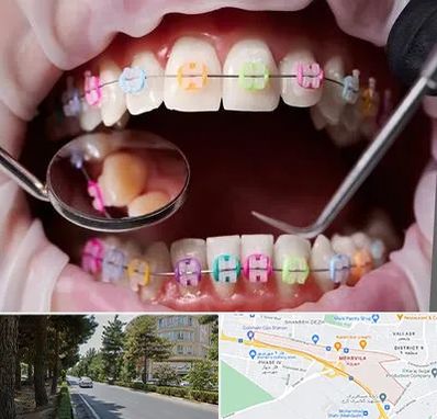 متخصص ارتودنسی در مهرویلا کرج