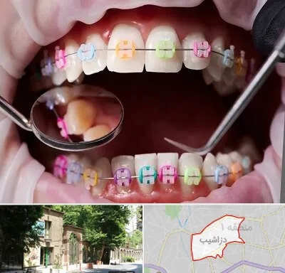 متخصص ارتودنسی در دزاشیب