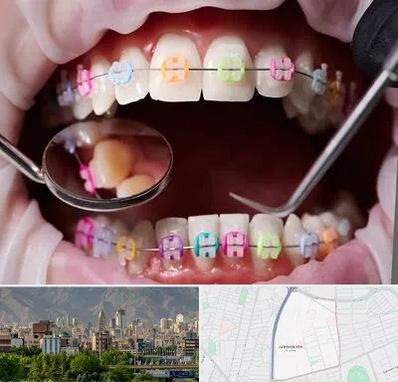 متخصص ارتودنسی در جمشیدیه