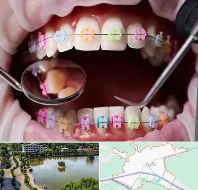 متخصص ارتودنسی در لنگرود