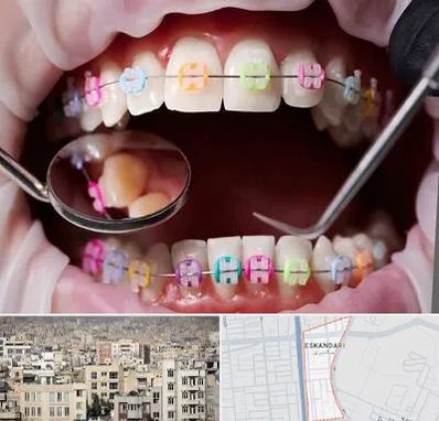 متخصص ارتودنسی در اسکندری