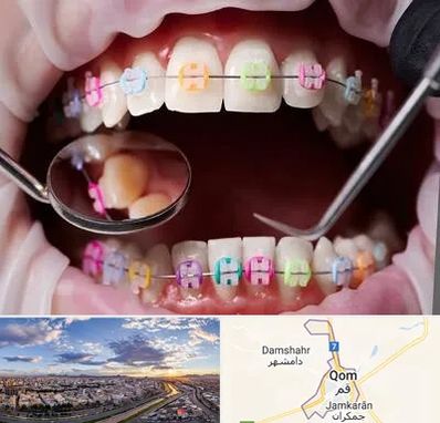 متخصص ارتودنسی در قم