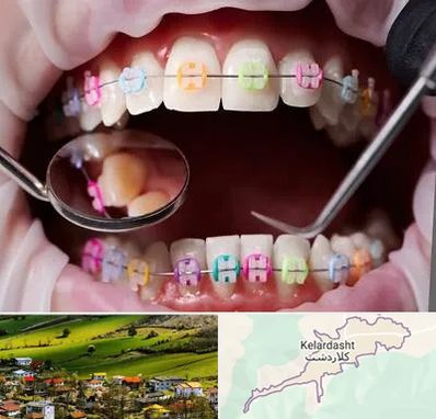 متخصص ارتودنسی در کلاردشت