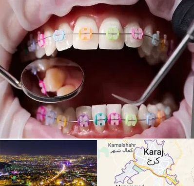 متخصص ارتودنسی در کرج