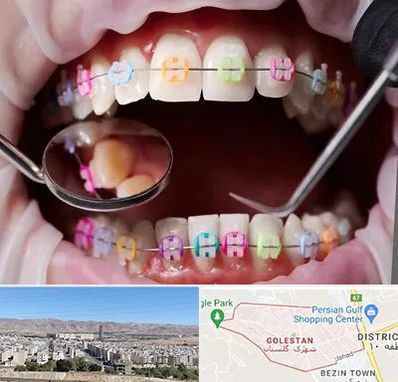 متخصص ارتودنسی در شهرک گلستان شیراز