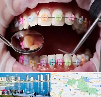 متخصص ارتودنسی در چیتگر 